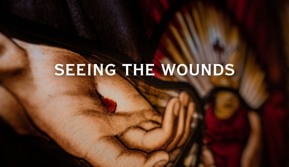 Seeing the Wounds