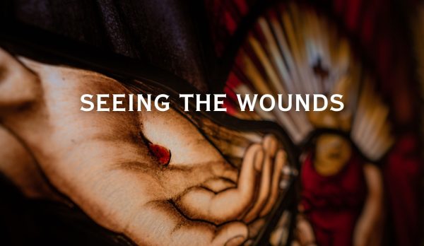 Seeing the Wounds